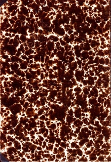 Przegląd Chirurgiczny : pismo poświęcone chirurgii, oftalmologii, otiatryi, laryngologii, akuszeryi, ginekologii, syfilidoligii i dermatologii : 1902